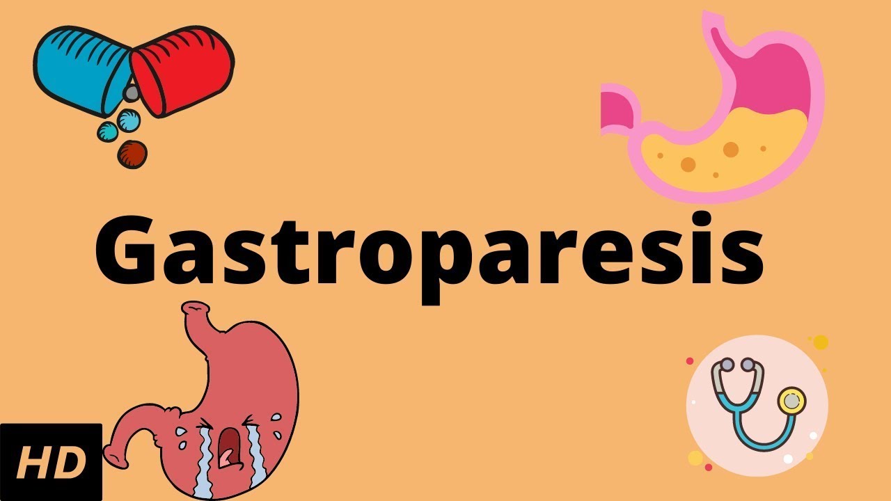 Gastroparesis, Causes, Signs and Symptoms, Diagnosis and Treatment.