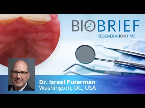 Geistlich Fibro-Gide®: Correction of Maxillary Anterior Soft Tissue Peri-implant Ridge Deficiencies
