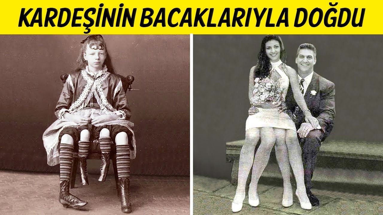 Gerçekten Var Olduklarına İnanmayacağınız 15 İlginç İnsan