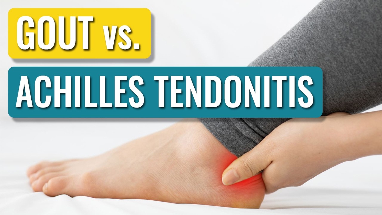 Gout in the Achilles Tendon: Symptoms & Treatment