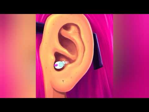 Gtszoom: Starfire's Ear Slides