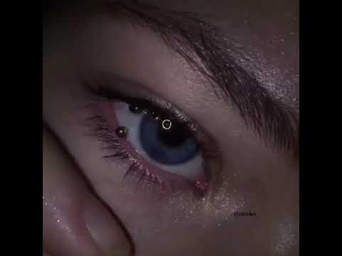 Gözümün  içine piercing yaptırdım