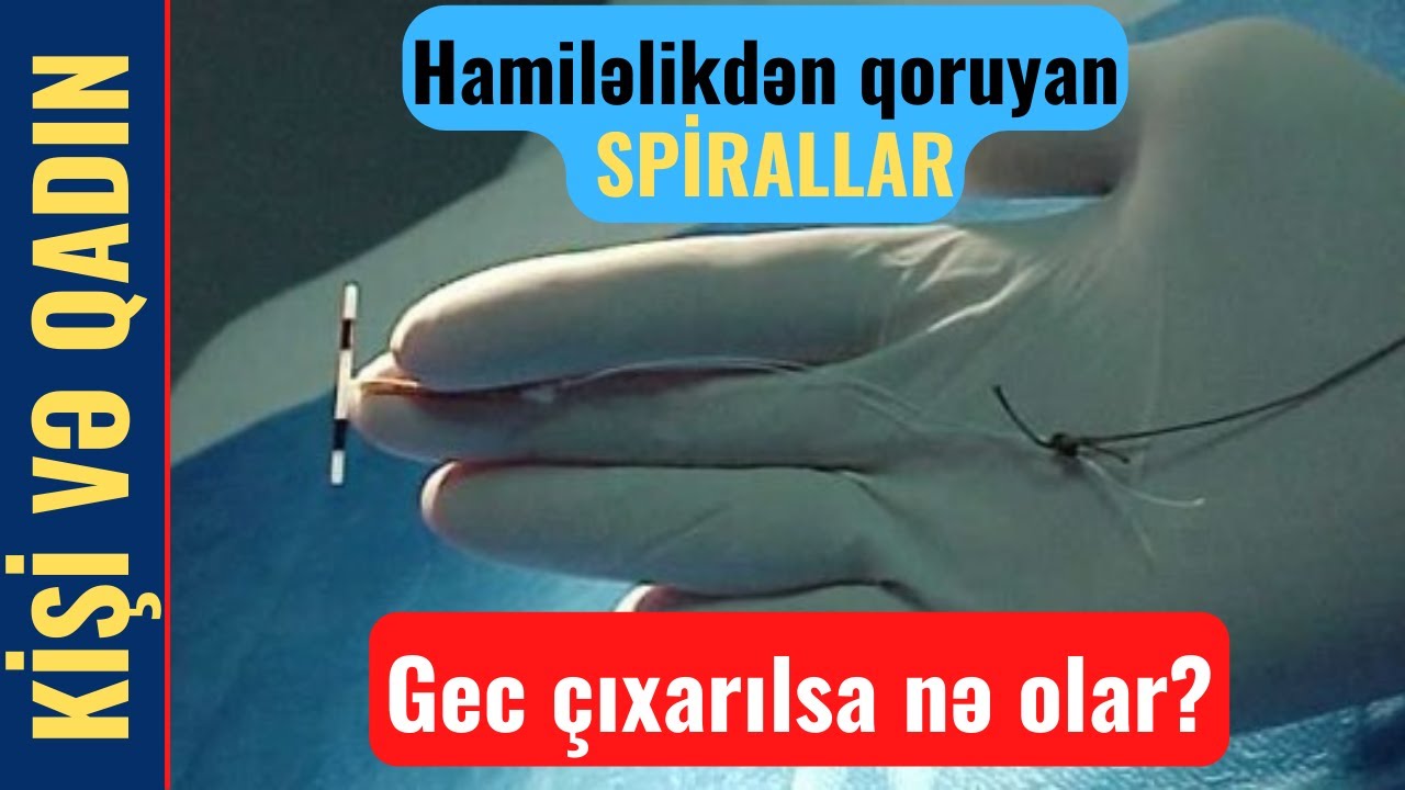 Hamiləlikdən qoruyan spirallar gec çıxarılsa nə olar? | Həkim məsləhəti