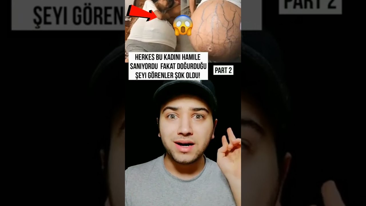 Herkes Bu Kadını Hamile Sanıyordu Fakat... 😱🤯👀