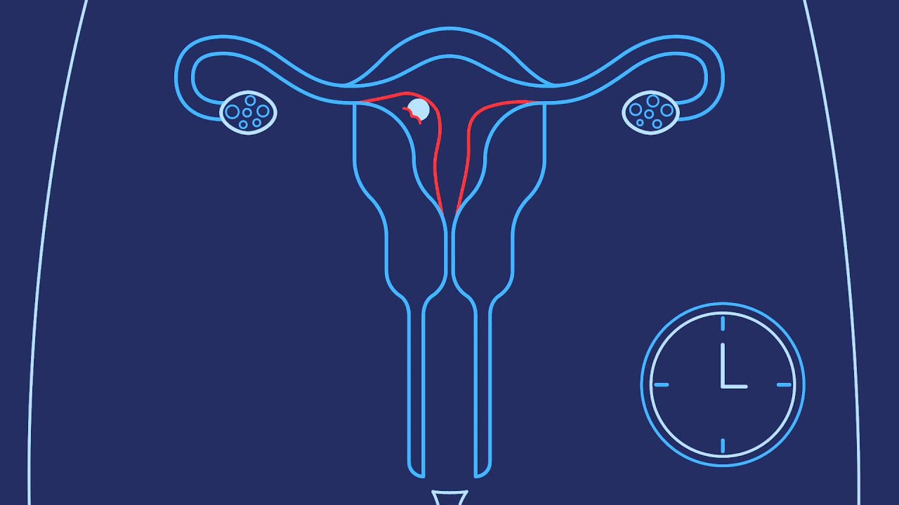 How Do You Get Pregnant? | Planned Parenthood Video