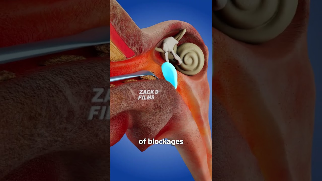 How Ear Spoons Work 🤔