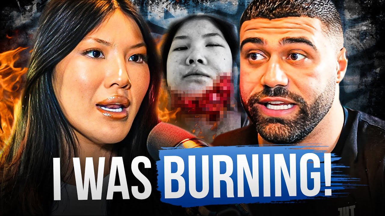 HOW I SURVIVED MY FACE BEING SET ON FIRE!! - SOPHIE LEE EP|44