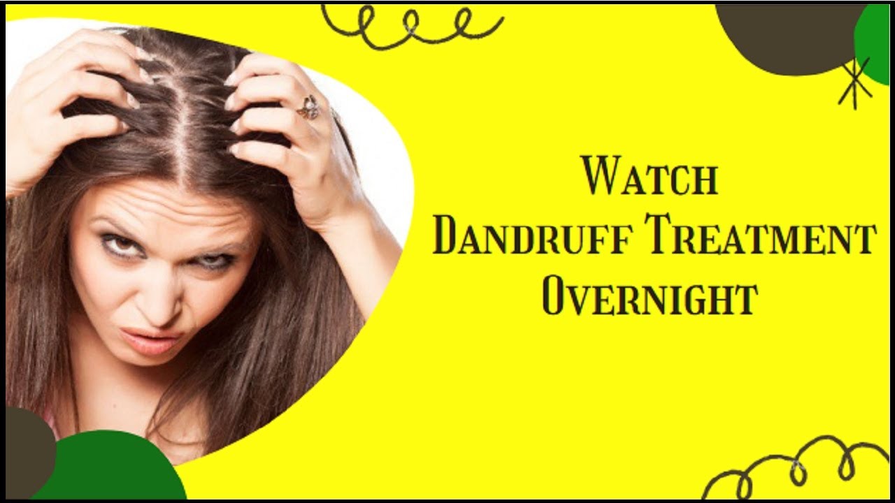 How To Get Rid Of Dandruff And Hair Fall | Seborrheic Dermatitis Scalp Treatment