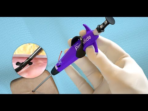 How to: Perclose ProGlide Single Device Deployment