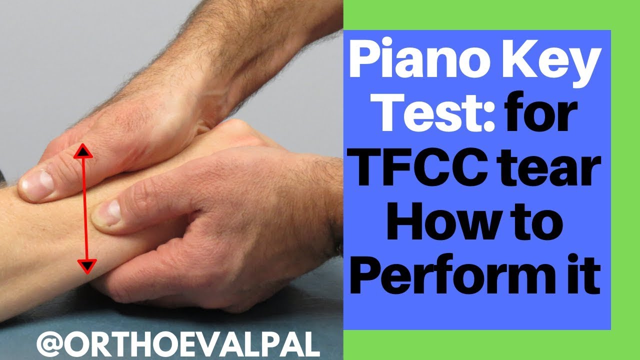 How to perform the Piano Key Test/for a TFCC Tear