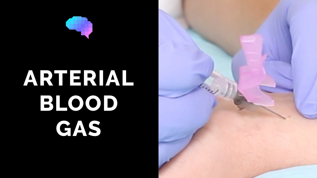 How to take an arterial blood gas (ABG) - OSCE guide | UKMLA | CPSA | PLAB 2