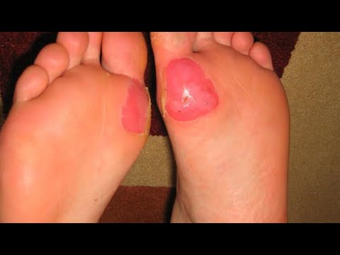 How to take care of feet for Special Forces | Green beret