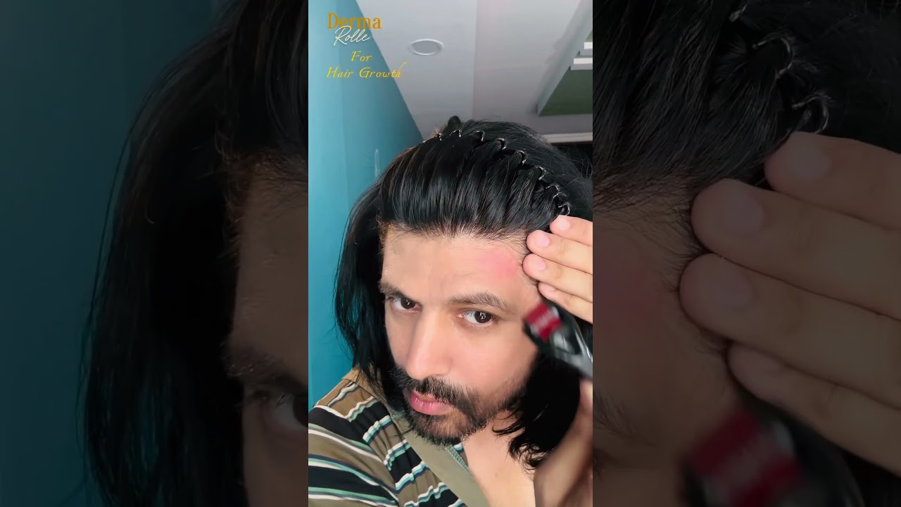 How to use derma roller. For hair growth. #dermaroller #hairgrowth #haircare