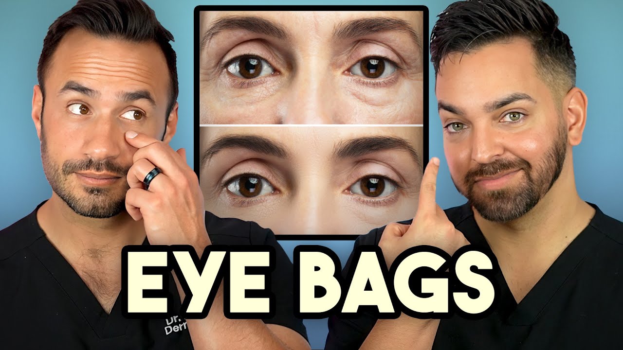 How Treat Under Eye Bags Like A Dermatologist