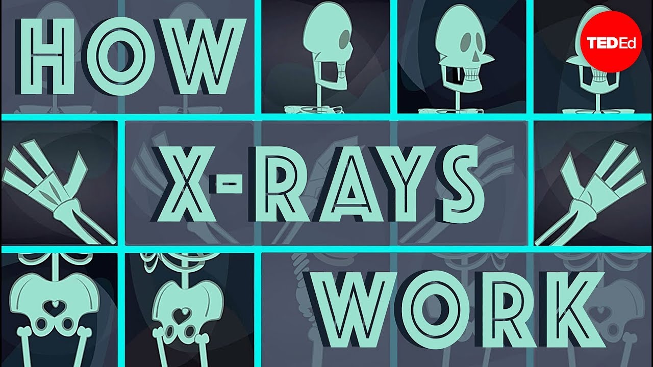 How X-rays see through your skin - Ge Wang
