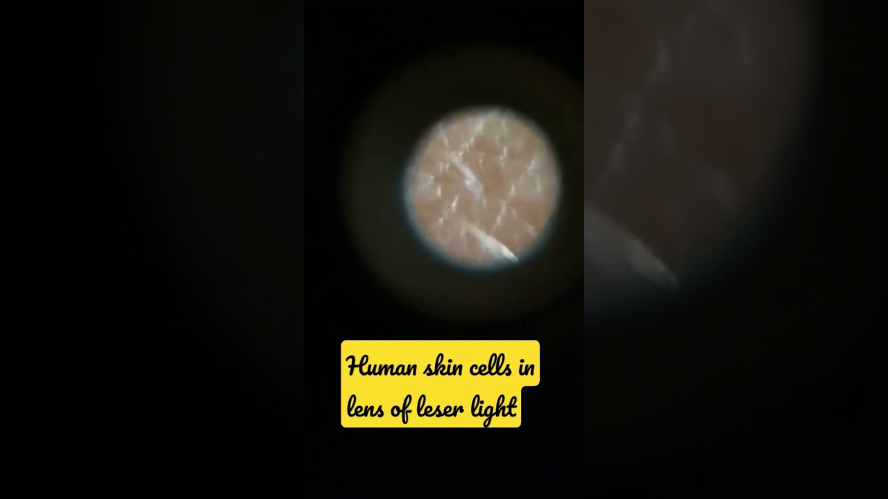 human skin cells in lens #art #crazwhy #science #lens #dinfolab