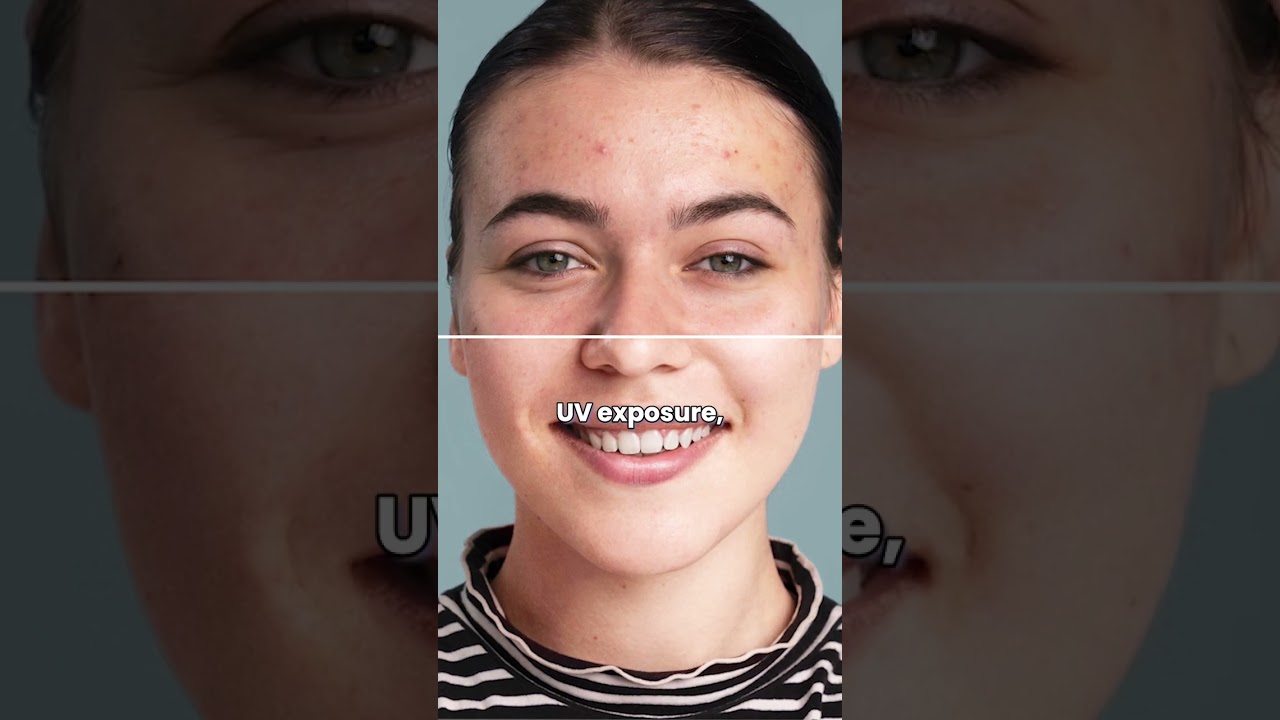 Hyperpigmentation and Erythema