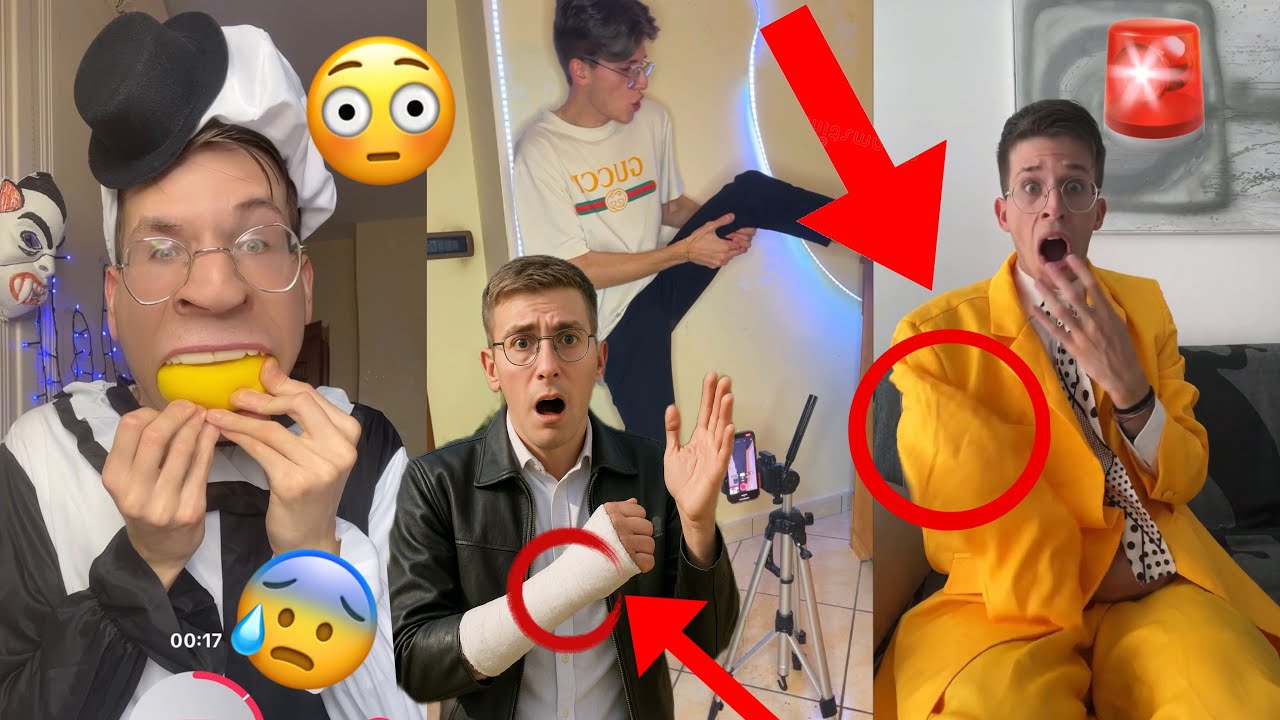I BROKE arm😳😭TUTORIAL‼️shorts Transitions😰 #tutorial #youtube #magic