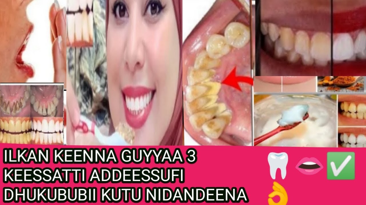 ILKAN KEENNA GUYYAA 3 KEESSATTI ADDEESSUFI DHUKUBUBII KUTU NIDANDEENA