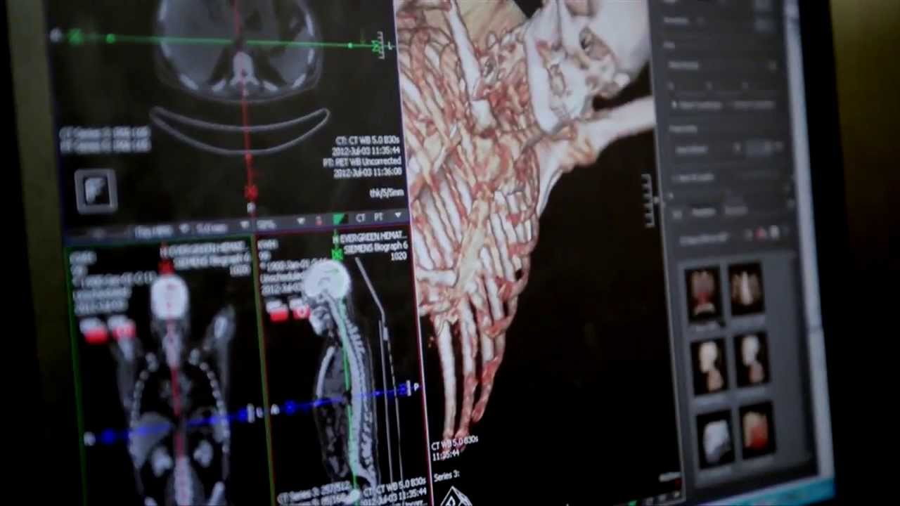 Imaging Endpoints - About the Company