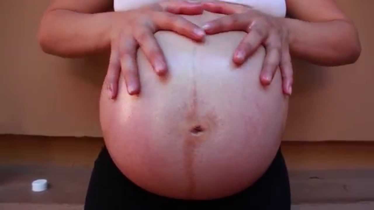 In helps of stretch mark prevention