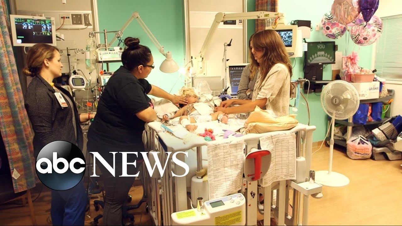 Inside Texas Conjoined Twins' Harrowing Separation Surgery
