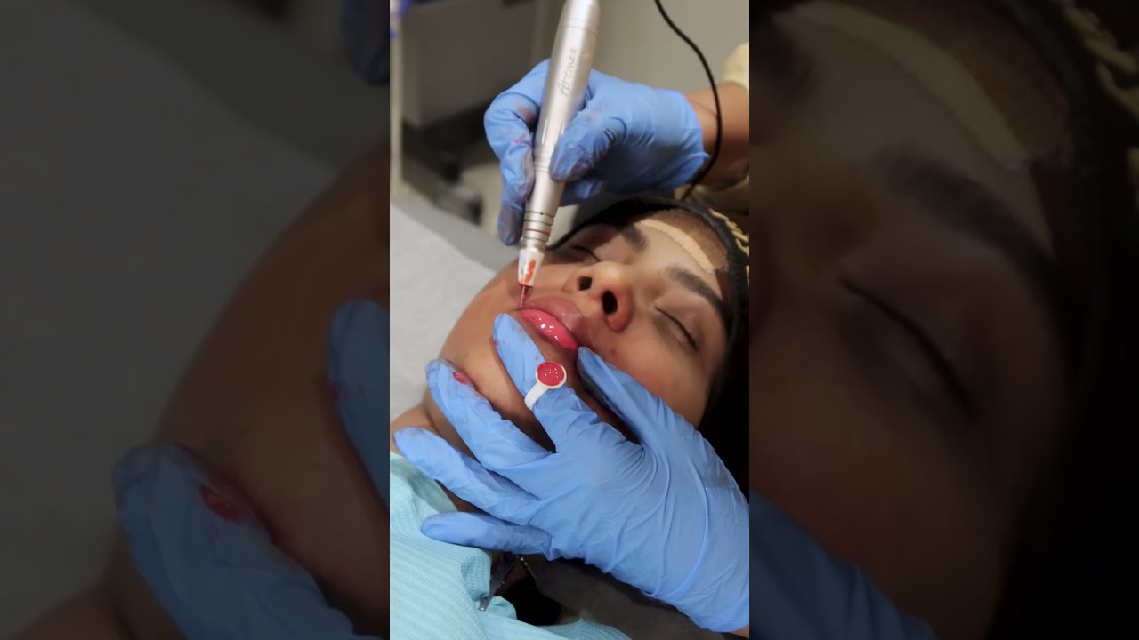 Introducing Lip Blush at Sarayu Clinics