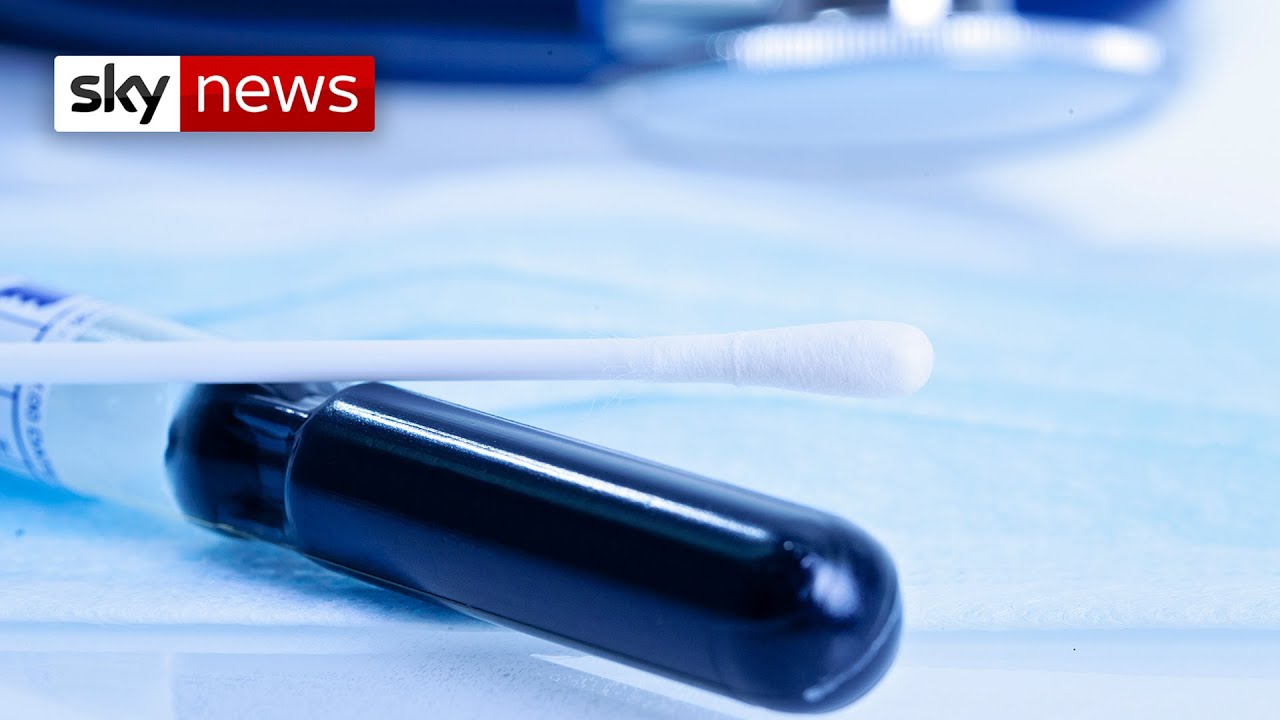 Is this the end of smear tests?