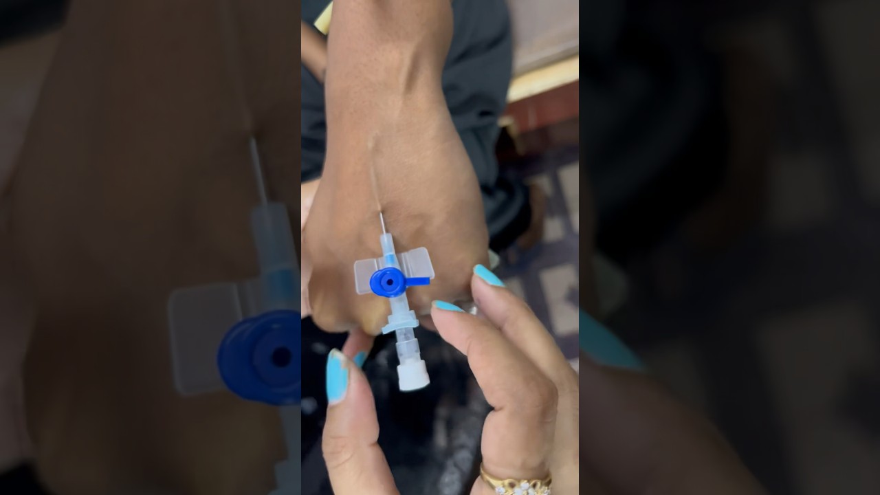 IV Cannulation procedure | IV cannula kaise lagate hain