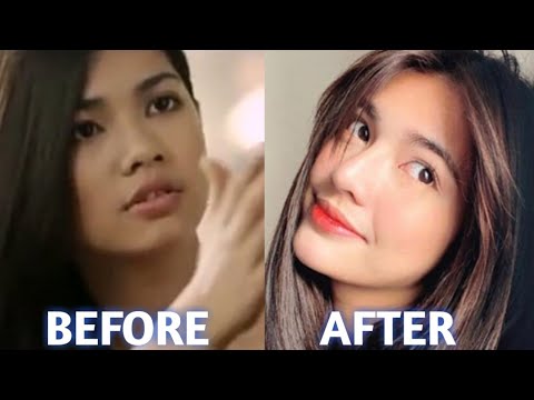 JANE DE LEON BEFORE AND AFTER!!