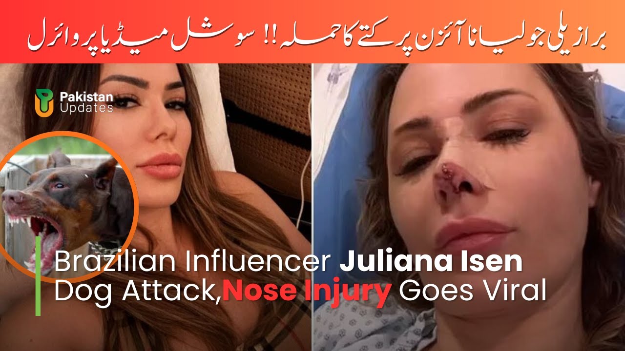 Juliana Isen Terrifying Dog Attack, Her nose bitten off | Pakistan Updates