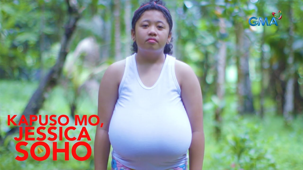 Kapuso Mo, Jessica Soho: 10-ANYOS NA BABAE MULA LAGUNA, NASA 12 KILO ANG BIGAT NG DIBDIB!