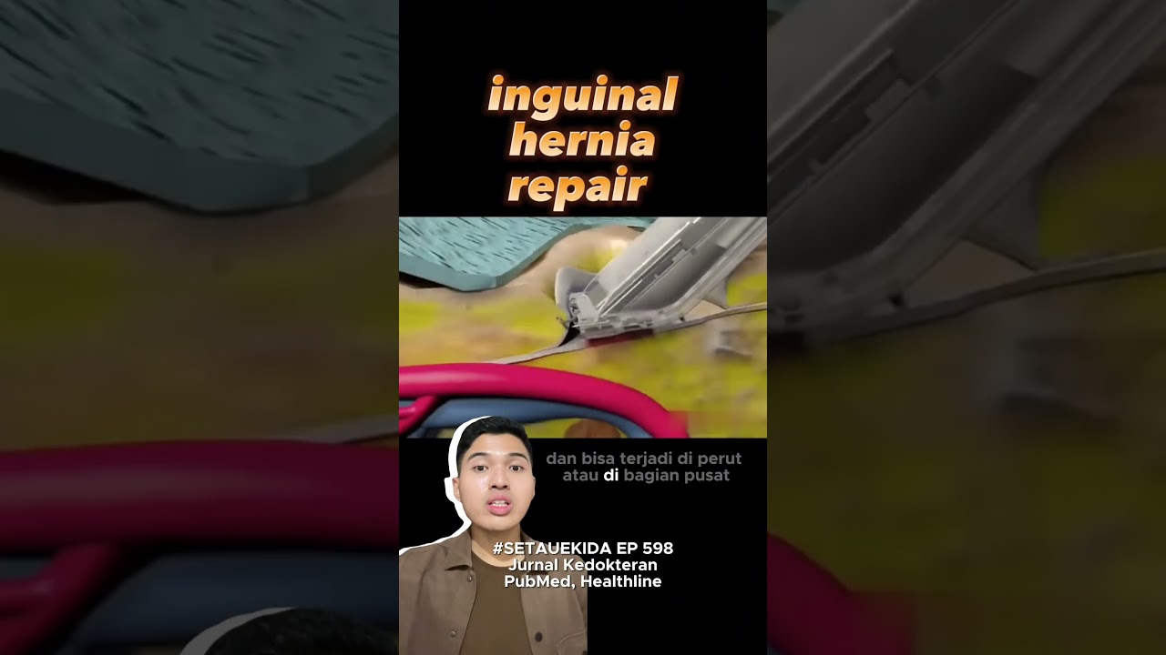 kasih tau yang hernia / turun berok #turunberok #hernia #operasihernia #setauekida #youtubehealth