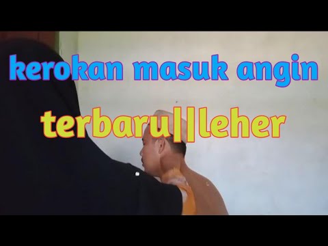 kerokan masuk angin terbaru||leher