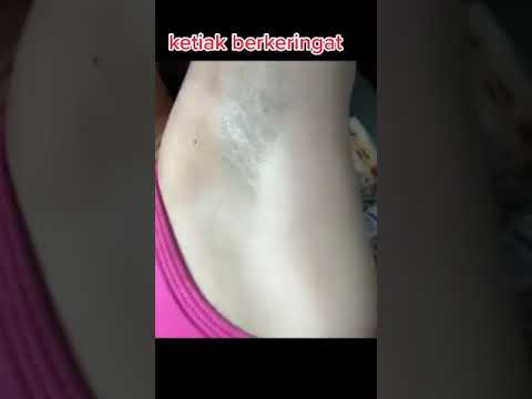 ketek/ketiak berkeringat