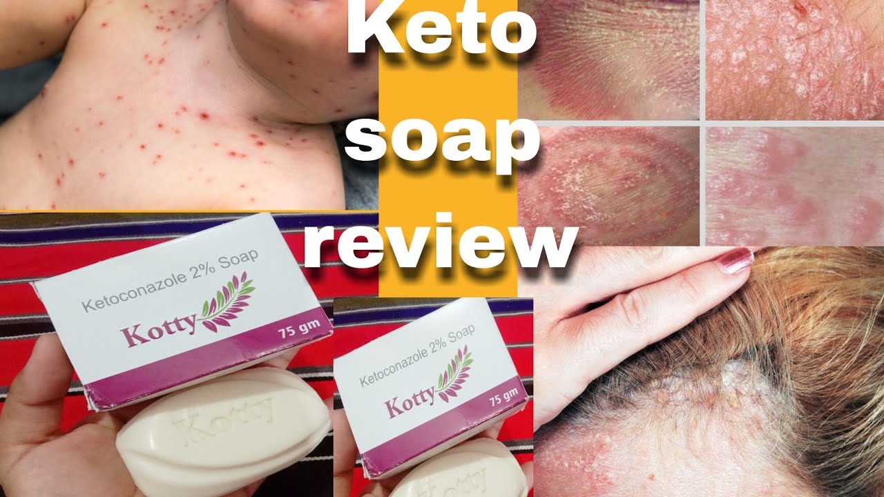Keto Soap Uses, Benefits, Side Effects | Ketoconazole (2% w/w) Soap👌