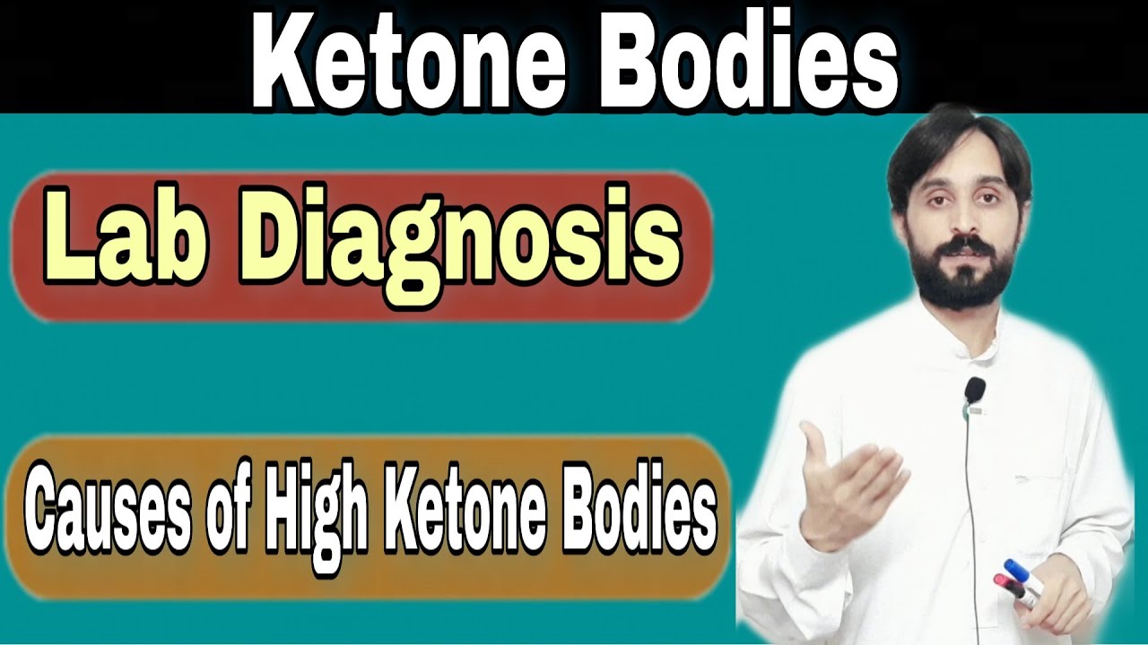 Ketone bodies (Causes and Diagnosis)
