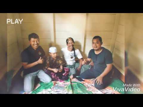 KHITAN MODERN (Sunat Tanpa Jarum Suntik Indonesia)