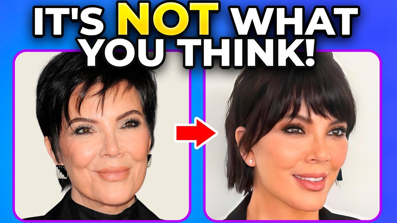 Kris Jenner's Face Explained: Deep Plane Facelift or Something Else?