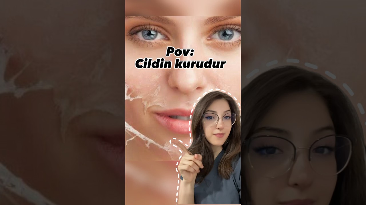 Kuru cilt belirtilerinden bazıları. Kuru cilt bakım videosu için takipte kalın✨ #keşfetbeniöneçıkar