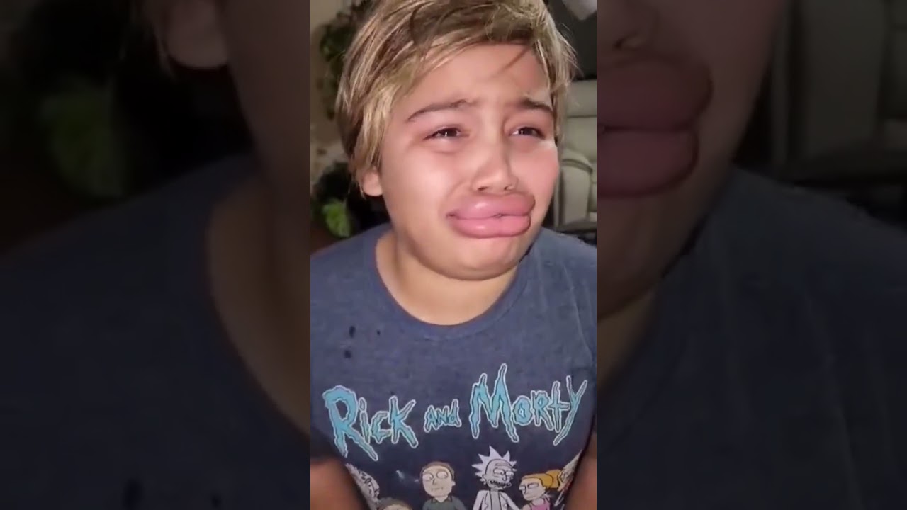Kylie Jenner lip challenge gone wrong! #trend #tiktok