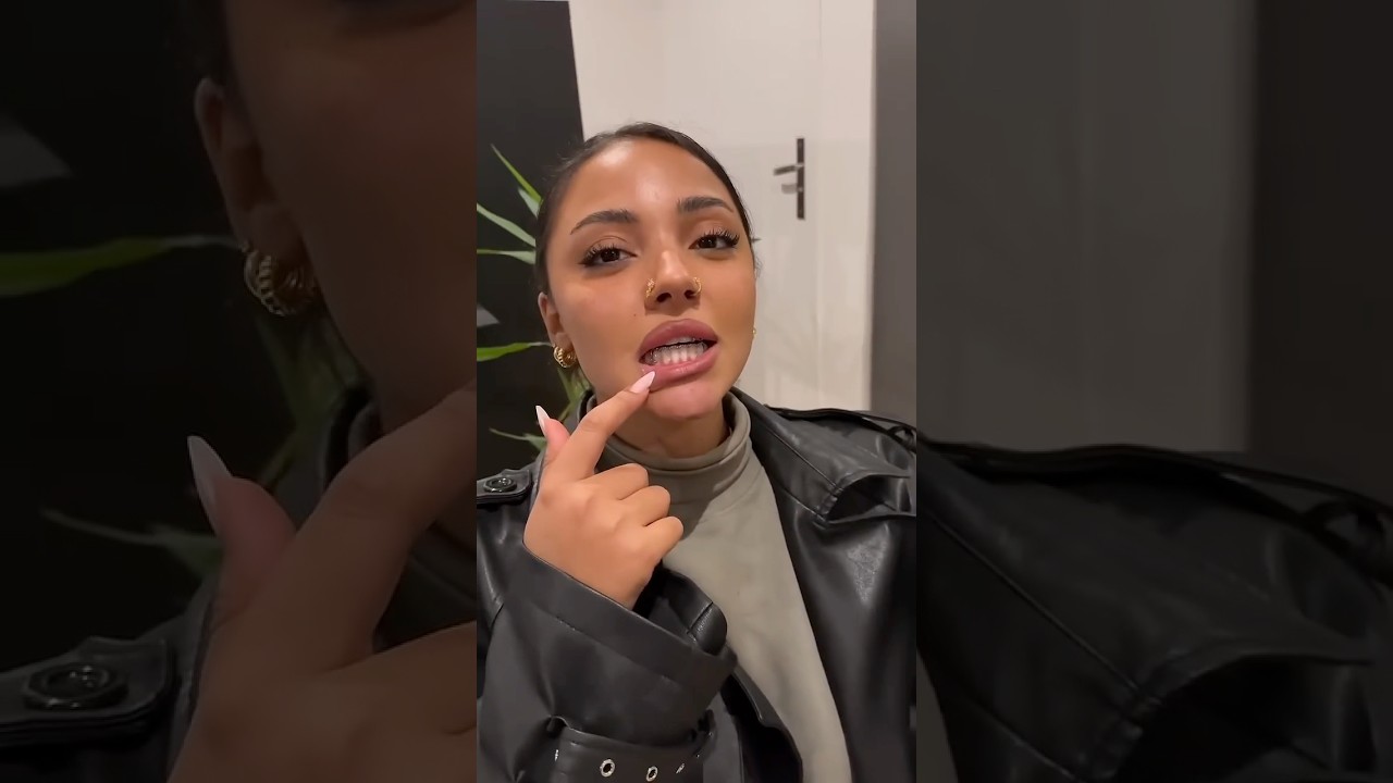 Le 1e grillz de Wejdene 💎🦷