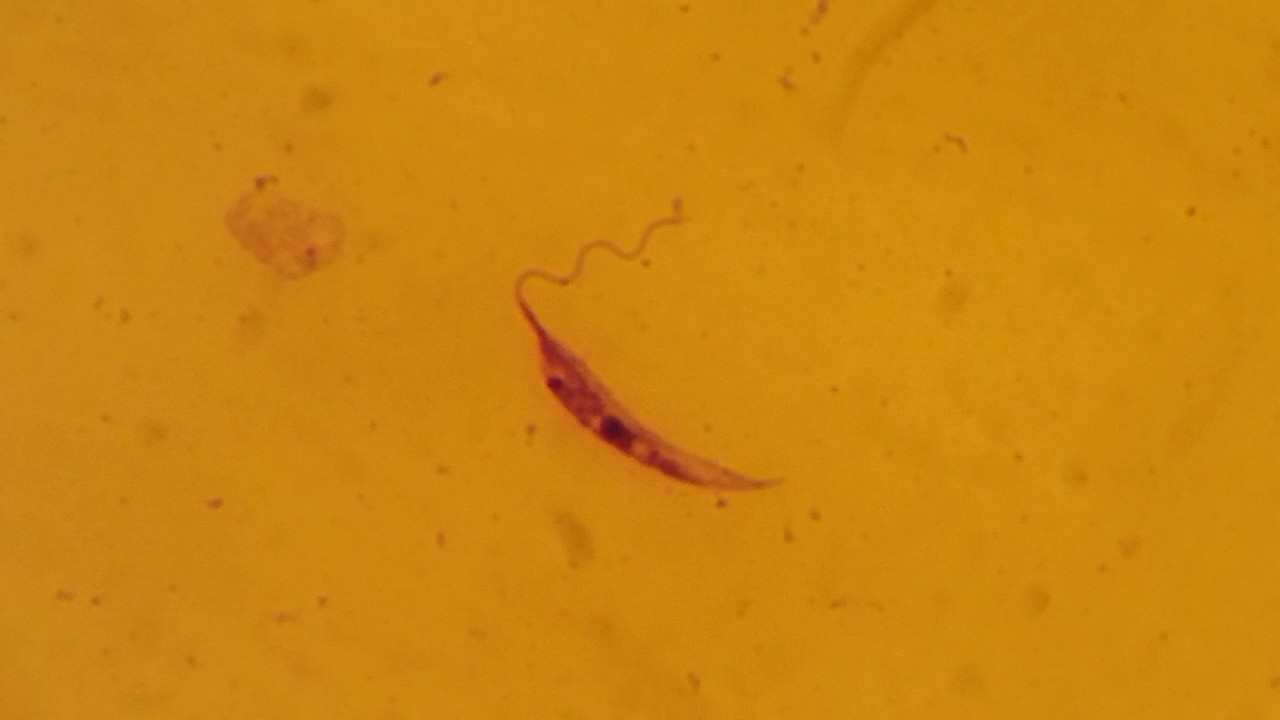 Leishmania donovani   promastigote form