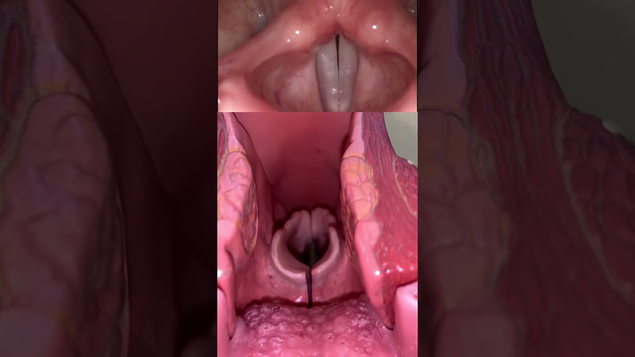 Live view of the vocal cords! #anatomy #medical #funfacts