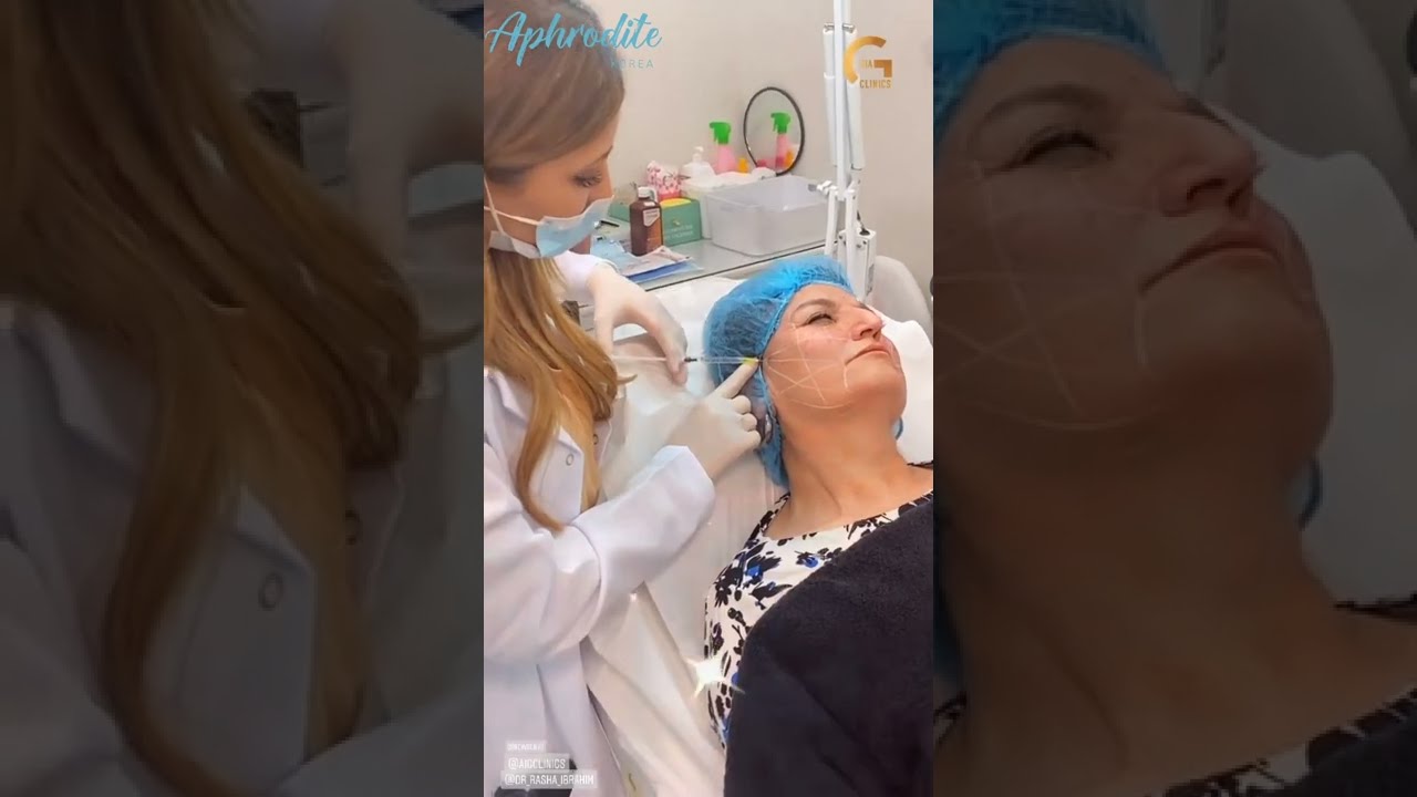 Looking Young & Beautiful ❤ Aphrodite Face Lift