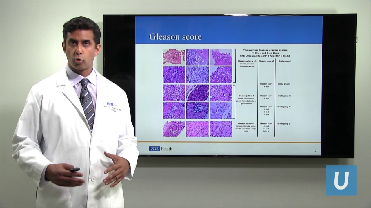Making Decisions After Being Diagnosed with Early Stage Prostate Cancer | UCLAMDChat