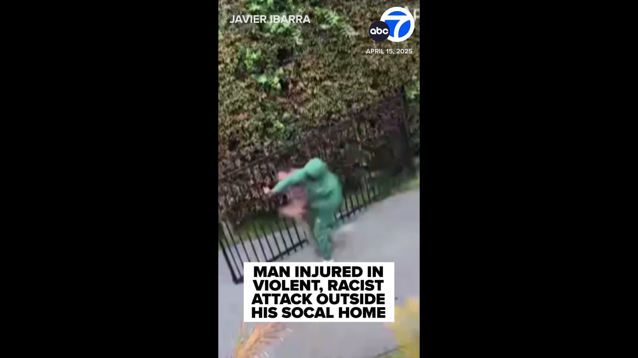 Man beaten in racist attack outside his SoCal home
