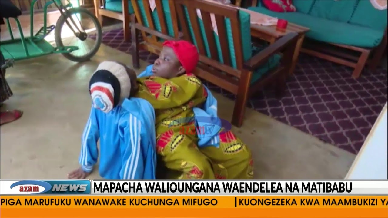 Mapacha walioungana, Maria na Consolata bado wako katika chumba cha wagonjwa mahututi