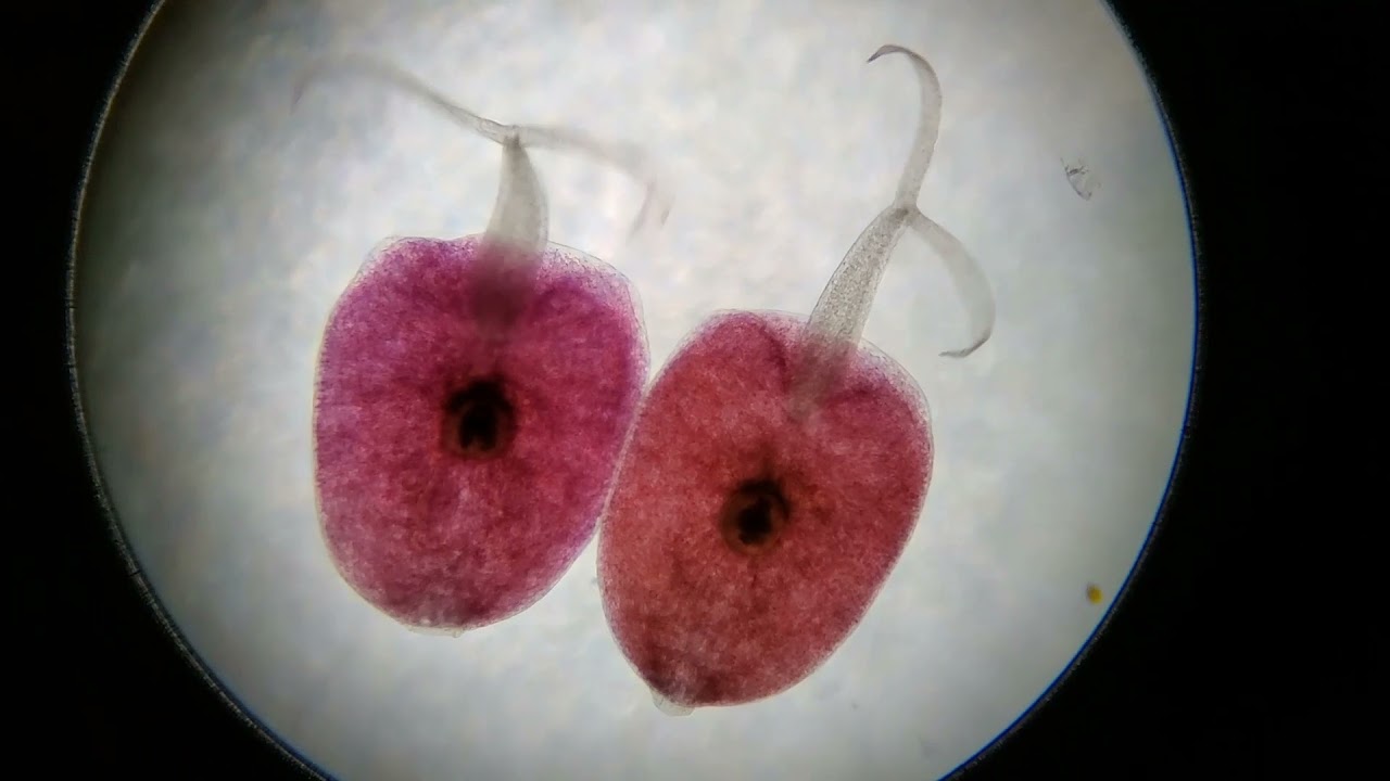 Marine Trematode/Fluke Cercariae