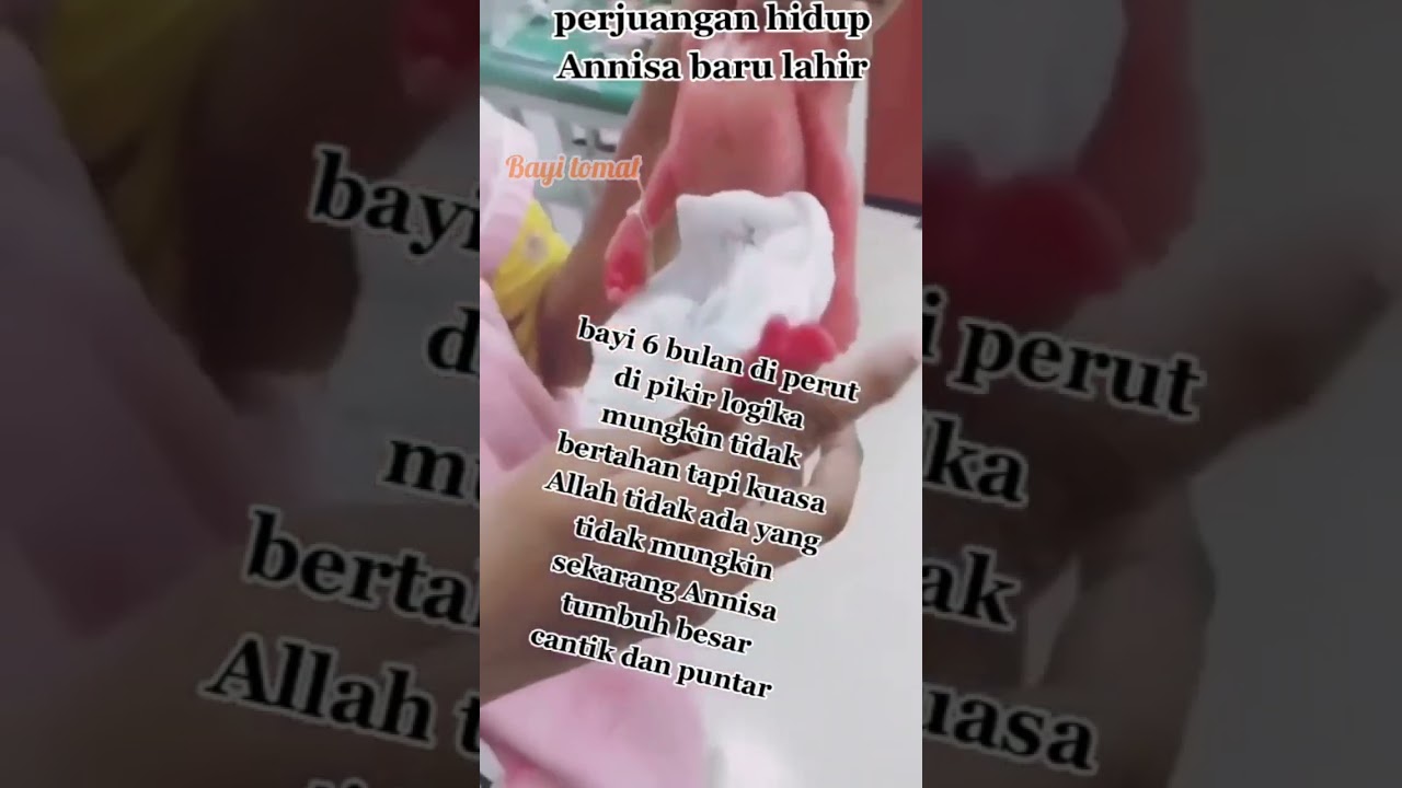 Masya Allah Perjuangan Annisa Bayi Lahir usia 6 bln 🥲semoga kelak menjadi anak Cerdas & sukses 🤲amin